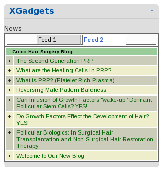 xgadgets_widget_example.png