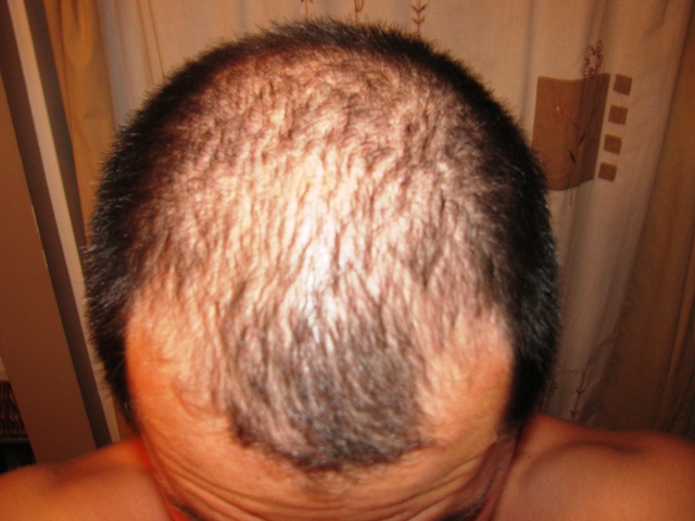 Before