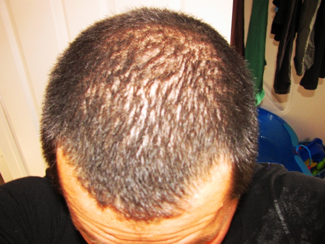After