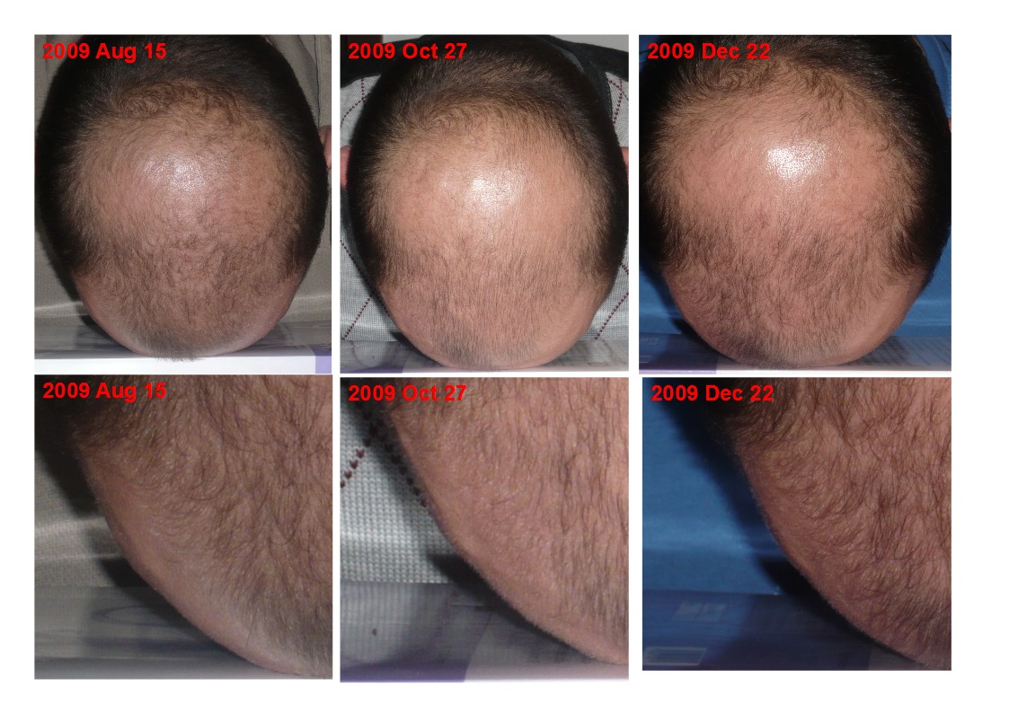HairCompare.jpg