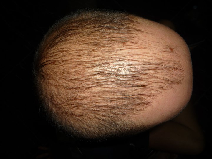 me before