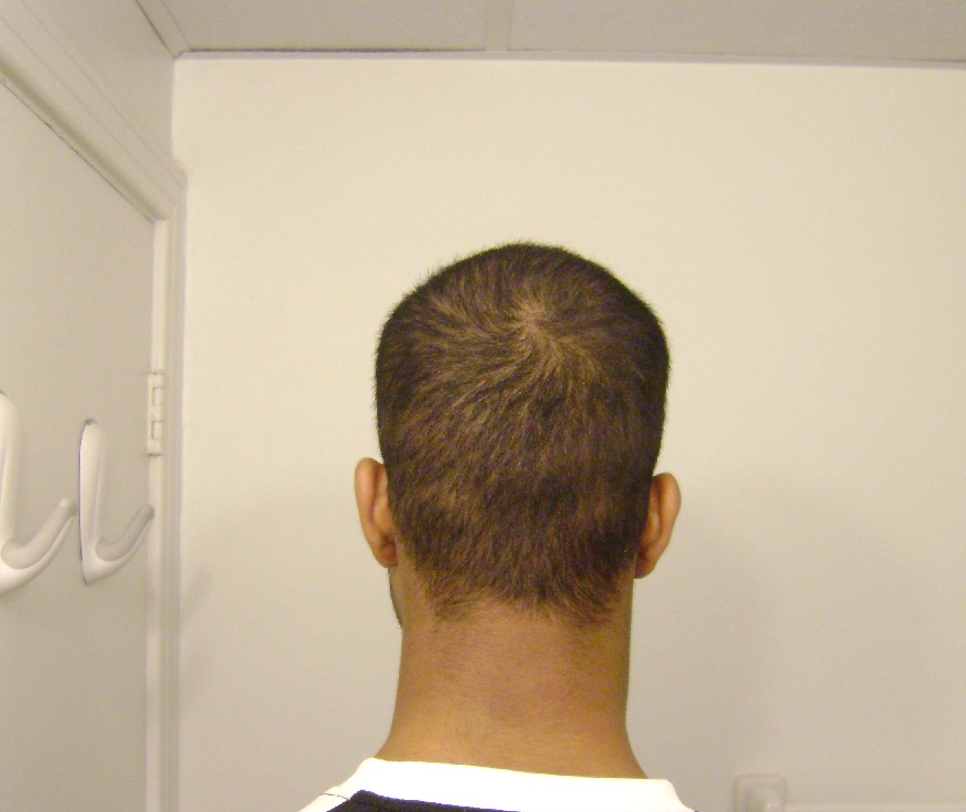 Back