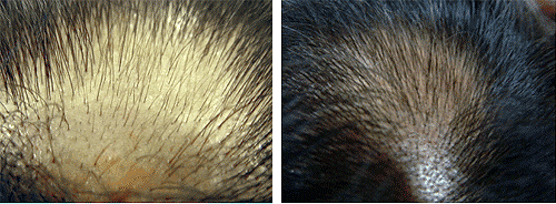 6 week before/after